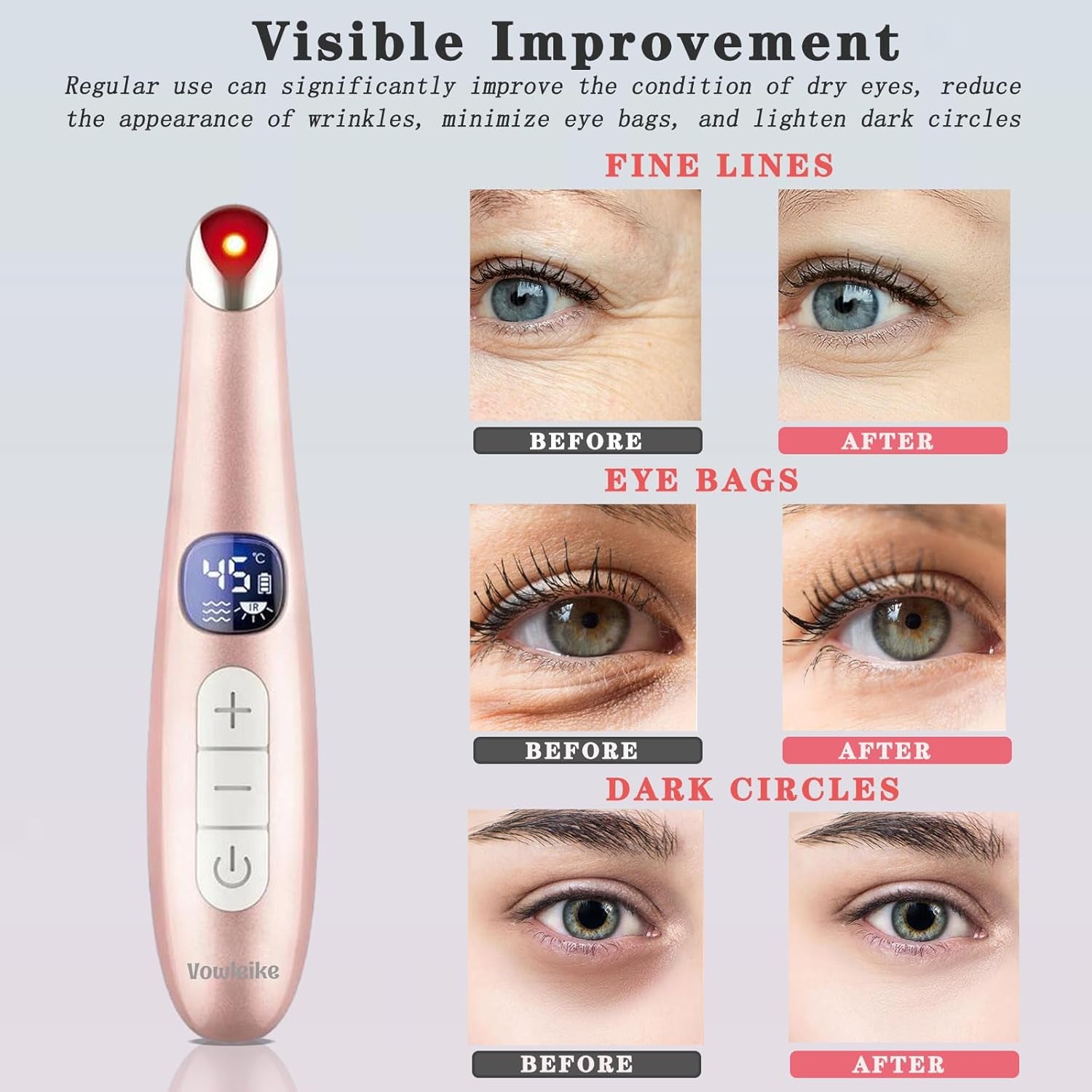 Vowleike Eye Lift Wand 3 in 1 Vibrating 98°F to 113°F LCD Eye Massager for Dry Eyes | Dark Circles and Puffiness Rose Gold